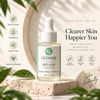 GLOSSIE™ Clear Balance Anti Acne Serum — 30 ML